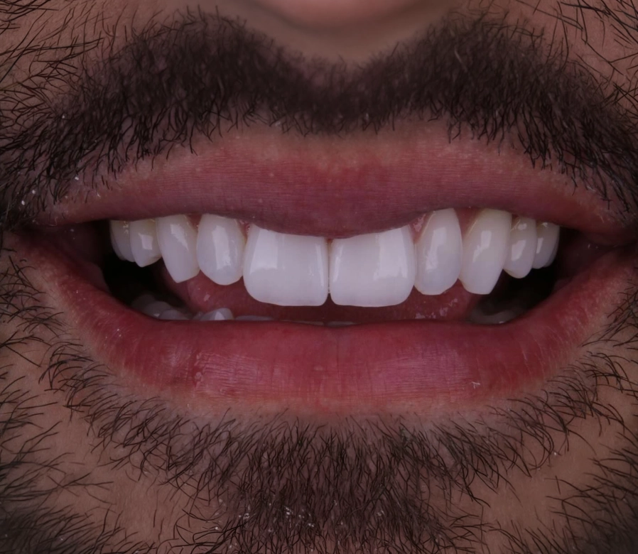 DEPOIMENTO 3.2